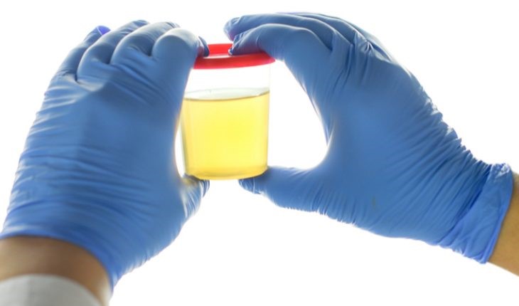 Synthetic Urine In Bottle Evergreen Davis CA